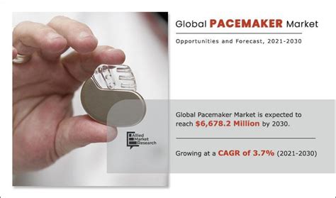 Pacemaker Market Size, Share & Growth Analysis | Report 2030