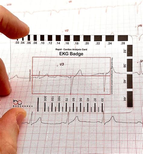 EKG PVC Badge Card for Accurate ECG Interpretation, No Calipers Needed ...