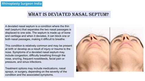 What is Deviated Nasal Septum | PDF