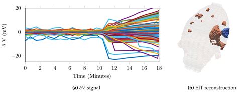 A Versatile and Reproducible Multi-Frequency Electrical Impedance ...
