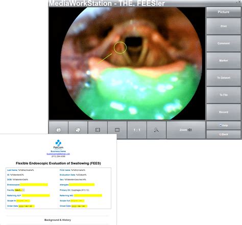 Swallowing Fees | PatCom Medical Inc.