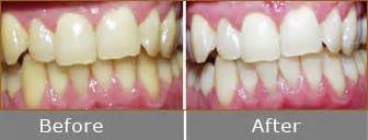 Cosmetic Dentistry Hyderabad