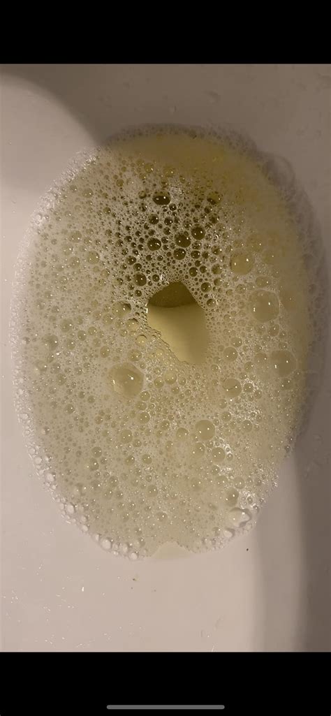 I've been experiencing foamy pee for the last couple of months. 22 year ...