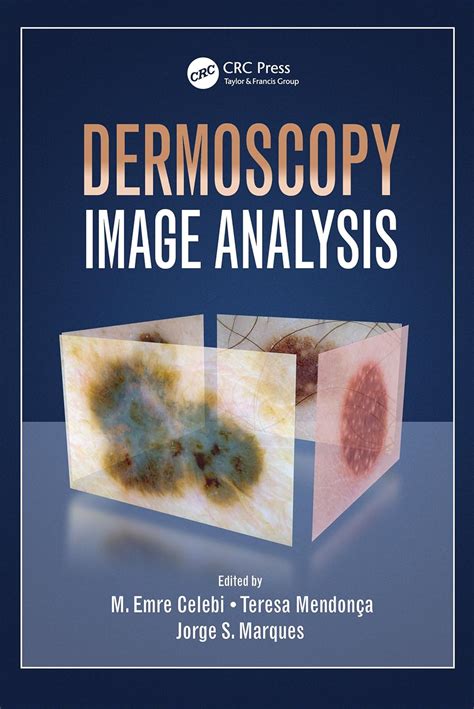 Dermoscopy Image Analysis (Digital Imaging and Computer Vision) eBook ...