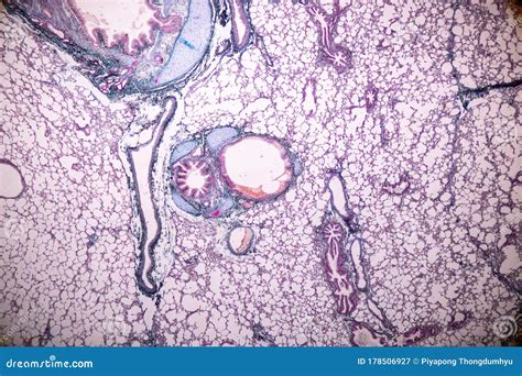 Image result for Tissue Sample Drawing Under Microscope