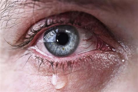 What Are the Causes of Watery Eyes? - Step To Health