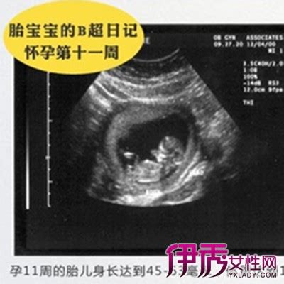 【b超单怎么算胎儿体重】【图】b超单怎么算胎儿体重 根据B超数据计算胎儿体重的公式(2)_伊秀亲子|yxlady.com