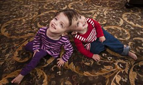 Conjoined Twin Myslexia South Park