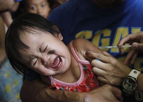 Measles oubreak kills 261 people in Philippines