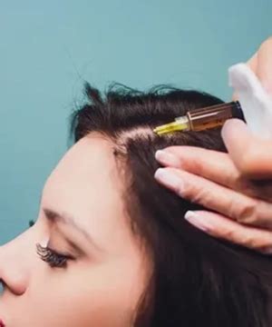 Advanced Y-Cell PRP Hair Regrowth Therapy in Tambaram