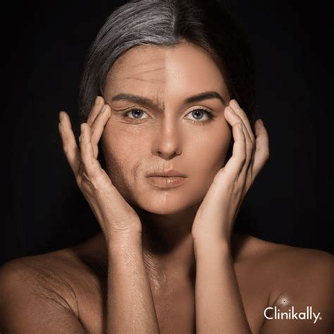 Caprylic Triglyceride Skin: Benefits, Side Effects & More | Clinikally