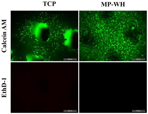 Marine Plankton-Derived Whitlockite Powder-Based 3D-Printed Porous ...