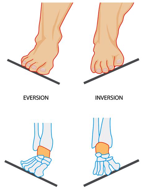 Pin on Custom Foot Orthotics