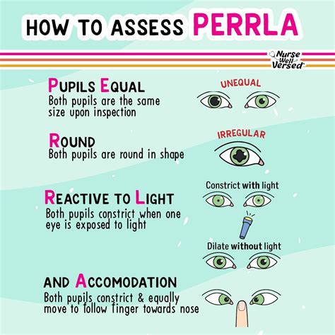 👁️ PERRLA Explained 🔍 Pupils Equal: Both pupils should be the same size ...