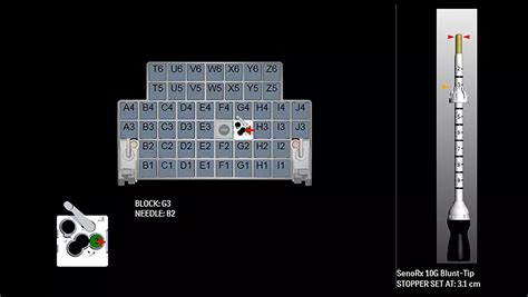 DynaCAD Breast | Philips