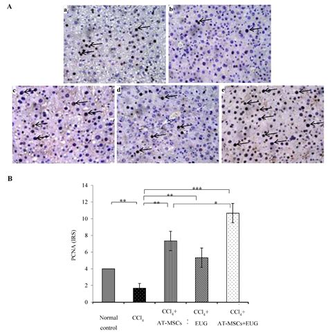 AT-MSCs Antifibrotic Activity is Improved by Eugenol through Modulation ...