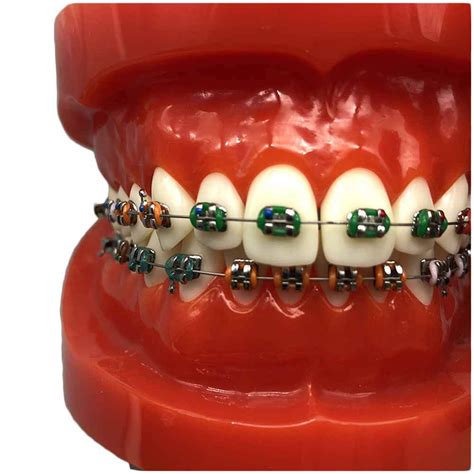 Wjh Orthodontic Teeth Model Dental Typodont With Mental Brackets ...