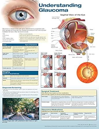 Buy Understanding Glaucoma Anatomical Chart Book Online at Low Prices ...