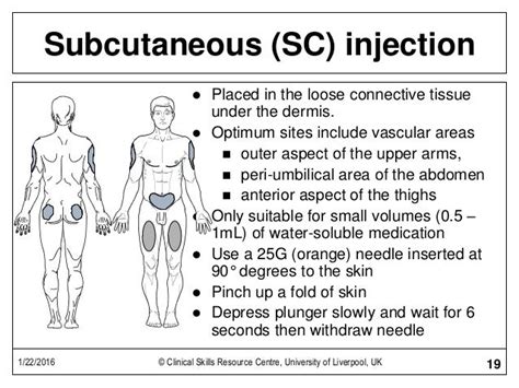Image result for SubQ Injection Technique