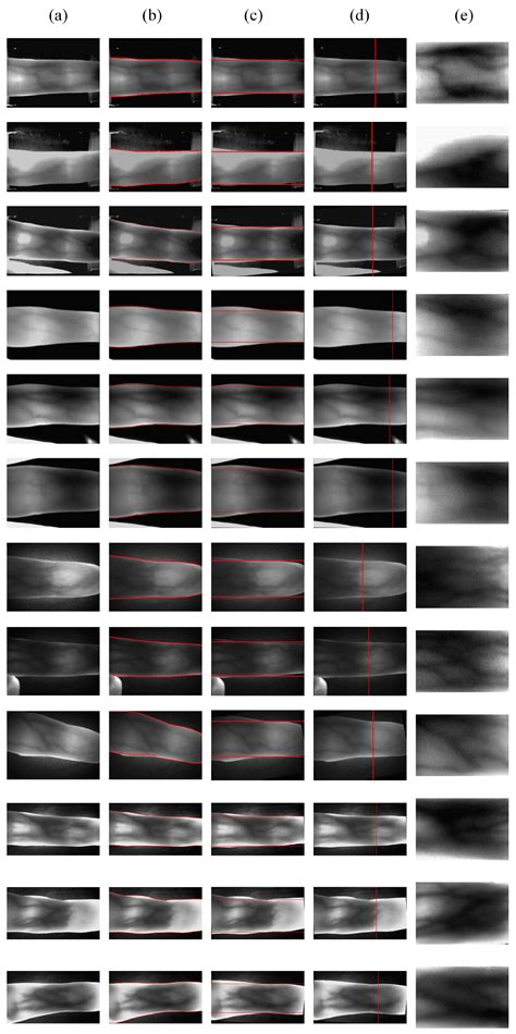 A Novel ROI Extraction Method Based on the Characteristics of the ...