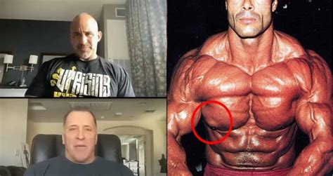 Gynecomastia Before And After Bodybuilder
