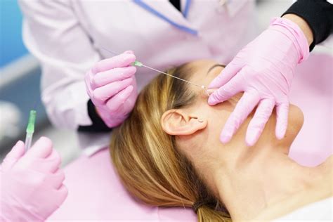 Image result for Fox Eye Thread Lift Procedure