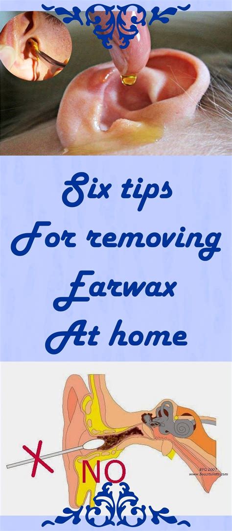 Diy ear wax removal - gilitfurniture