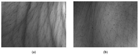 Collagen Hydrolysate Prepared from Chicken By-Product as a Functional ...