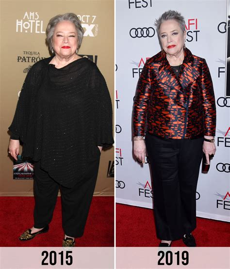 Kathy Bates Shows Off Her 100-Lb Weight Loss In New Photoshoot After ...