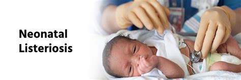 Neonatal listeriosis