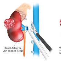 Best Urology Treatment In Seawoods | Dr. Gaurav Kasat