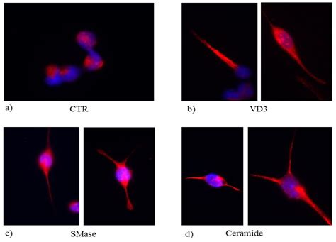 Vitamin D3 Enriches Ceramide Content in Exosomes Released by Embryonic ...
