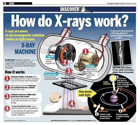 How Does X Ray Work