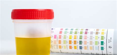 Understanding Pregnancy Urine Color: What It Means for Your Health