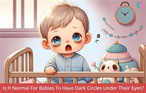 Dark Circles Under Baby's Eyes