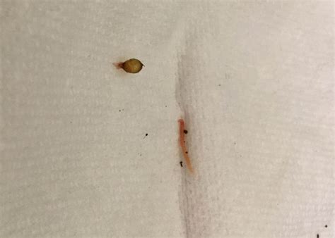 How to Harvest Worm Compost