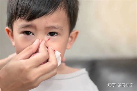 小孩流鼻血怎么处理（孩子流鼻血的原因、处理、预防措施你想知道吗？） | 说明书网