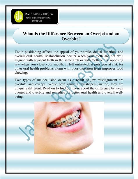 Overjet Vs Overbite