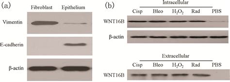 WNT16B from Ovarian Fibroblasts Induces Differentiation of Regulatory T ...
