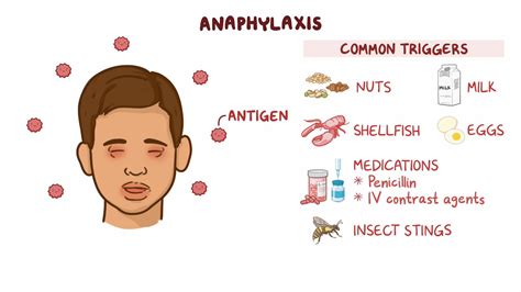 Define Anaphylactic Shocks at David Daigle blog