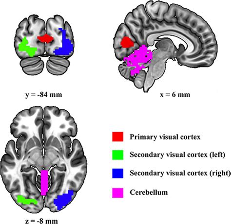 Primary Visual Cortex 的图像结果