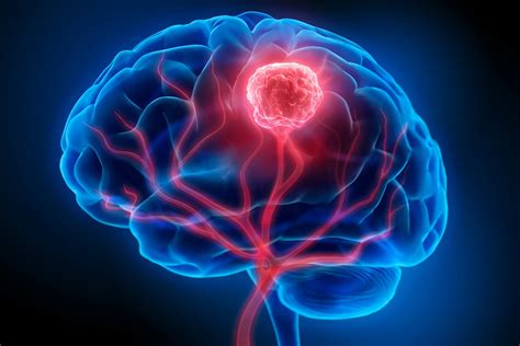 Brain Candy Quiz - Doquizzes