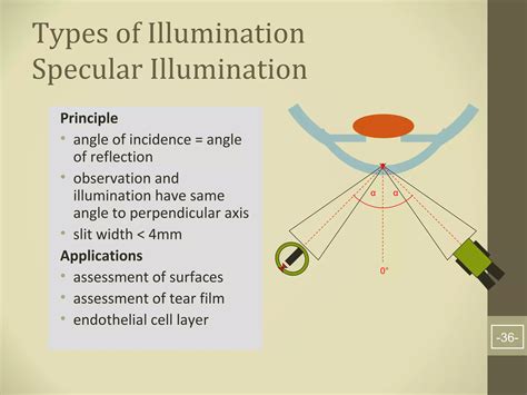 Image result for Slit Lamp Exam Tutorial