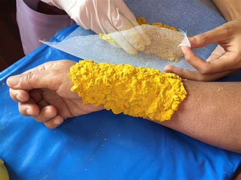 What Can I Use To Draw Out Pus From A Boil at Nicholas Packard blog