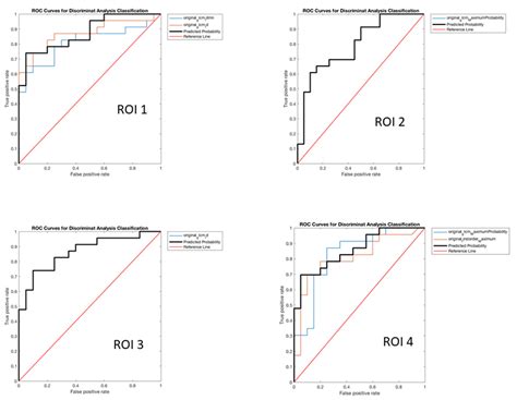 Radiomics Analysis of Brain [18F]FDG PET/CT to Predict Alzheimer’s ...