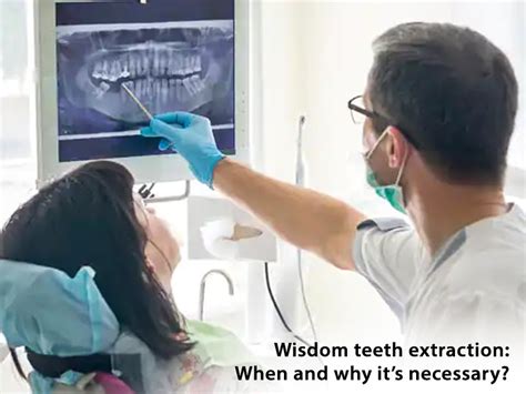 Wisdom Teeth Extraction 的图像结果
