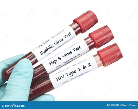 STD Blood Tests stock photo. Image of disease, hepatitis - 50675890