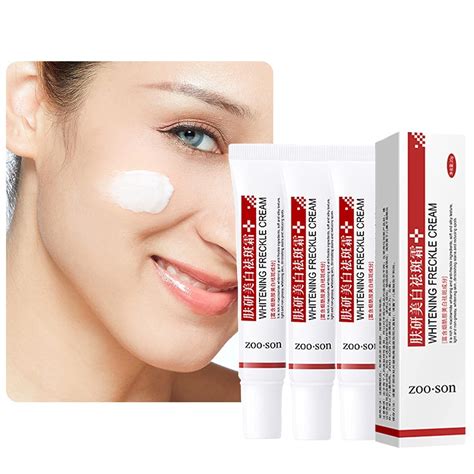 Freckle Cream, Pigmentation Removal Cream , Dark | Ubuy India