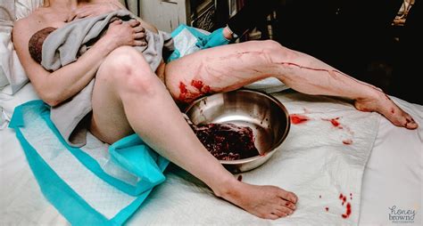 What Does Home Birth Look Like - EMSEKFLOL.COM