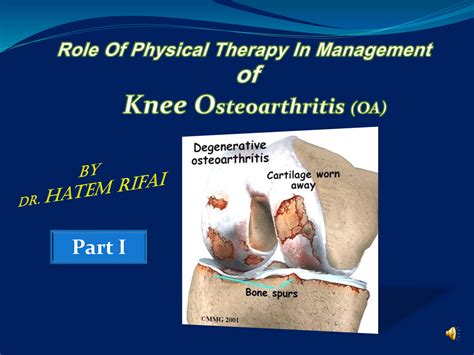 Arthro-: Meaning, Translation | ARTHROPODA definition and meaning – MYDAE